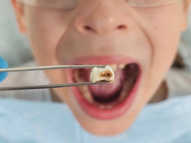 Best Pediatric Emergency Dentist in Tickfaw, LA
