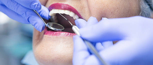 Best Emergency Dental Care for Broken or Chipped Teeth in Tickfaw, LA